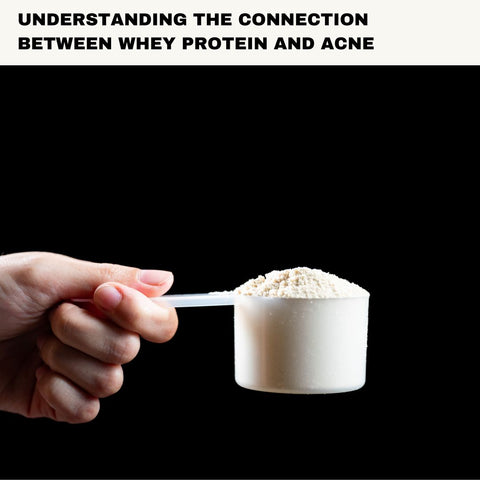 Understanding the Connection Between Whey Protein and Acne