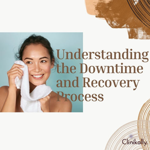 Understanding the Downtime and Recovery Process