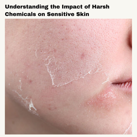 Understanding the Impact of Harsh Chemicals on Sensitive Skin