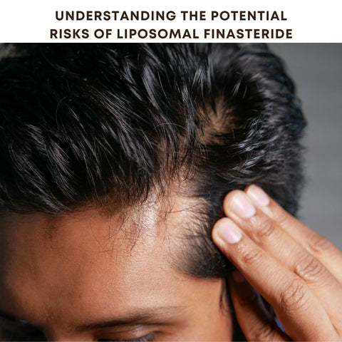 Understanding the Potential Risks of Liposomal Finasteride