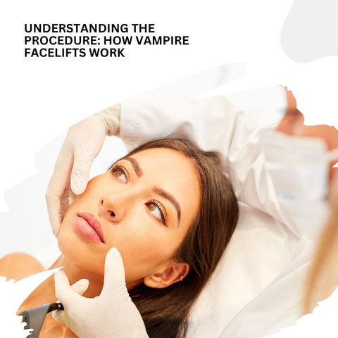 Understanding the Procedure: How Vampire Facelifts Work