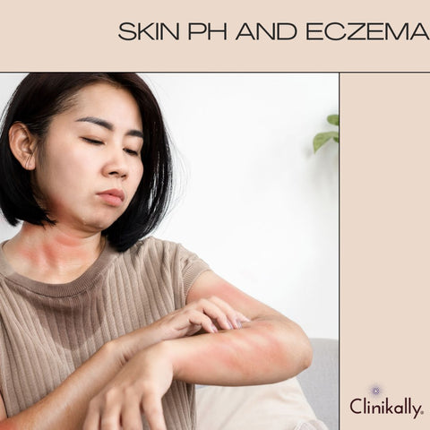 Skin pH and Eczema