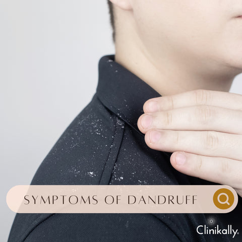Symptoms of Dandruff