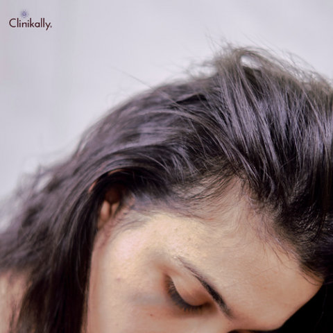 The Hazards of DMDM Hydantoin in Hair Care Products