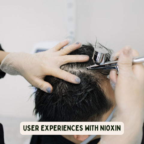 User Experiences with Nioxin