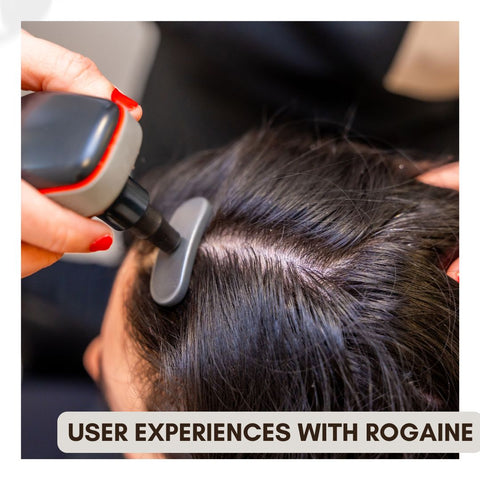 User Experiences with Rogaine