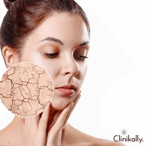 Dry, flaky, or damaged skin