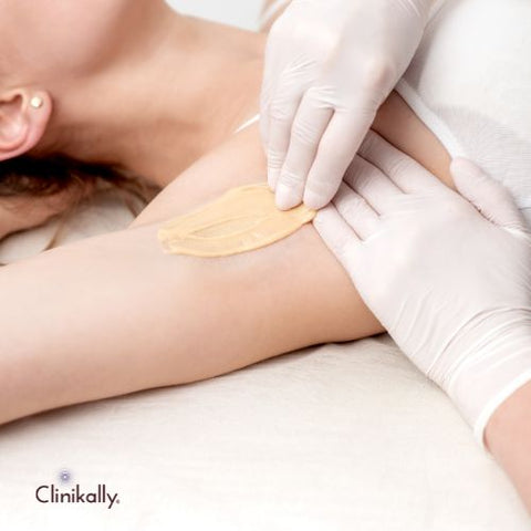 Getting Rid of Dark Armpits for Smooth, Even Skin