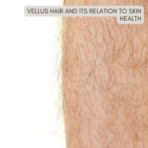 Vellus Hair and Its Relation to Skin Health