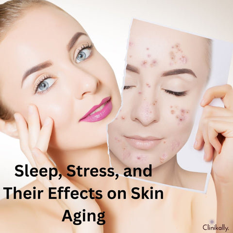 Sleep, Stress, and Their Effects on Skin Aging