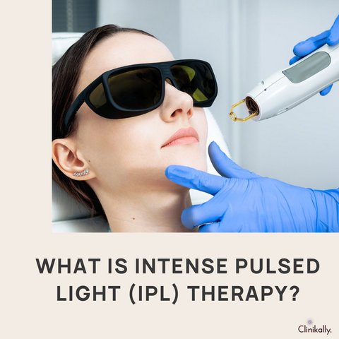 What is Intense Pulsed Light (IPL) Therapy?