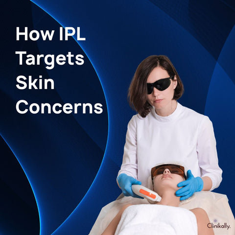 How IPL Targets Skin Concerns