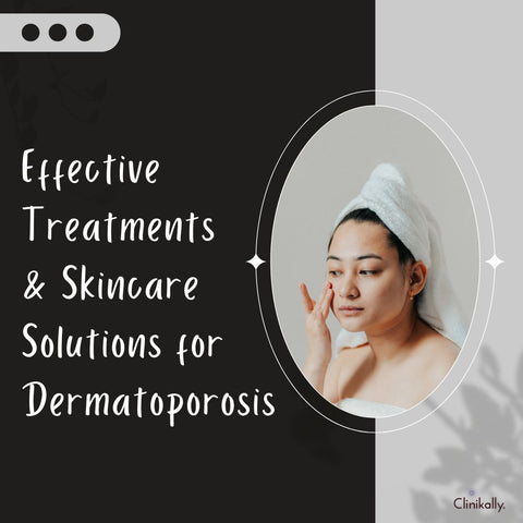 Effective Treatments & Skincare Solutions for Dermatoporosis
