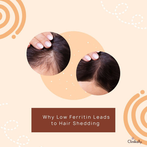 Why Low Ferritin Leads to Hair Shedding