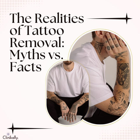 The Realities of Tattoo Removal: Myths vs. Facts