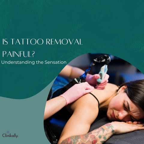 Is Tattoo Removal Painful? Understanding the Sensation