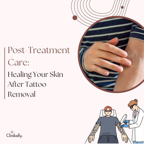 Post-Treatment Care: Healing Your Skin After Tattoo Removal