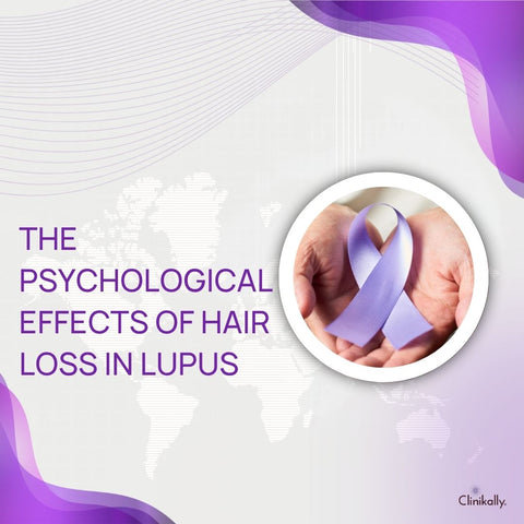 The Psychological Effects of Hair Loss in Lupus