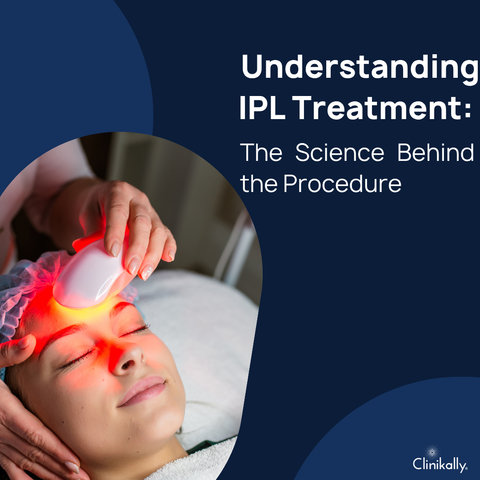 Understanding IPL Treatment: The Science Behind the Procedure