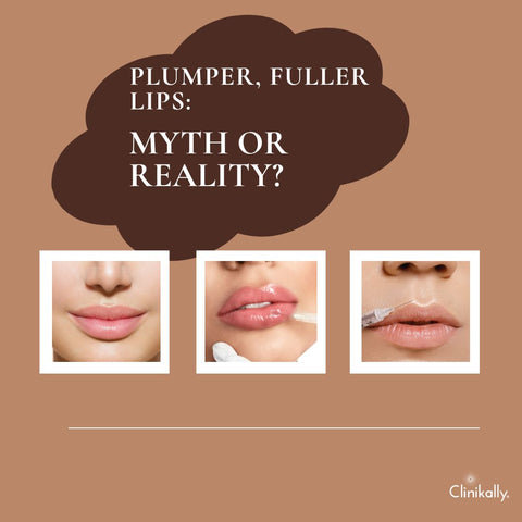 Plumper, Fuller Lips: Myth or Reality?