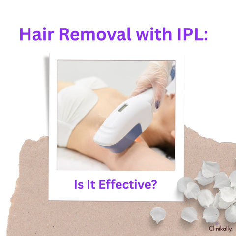 Hair Removal with IPL: Is It Effective?