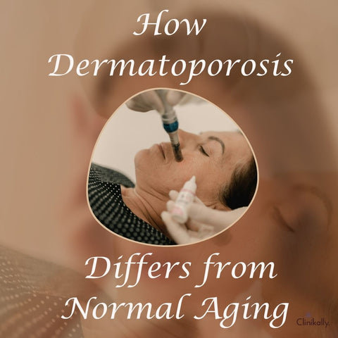 How Dermatoporosis Differs from Normal Aging