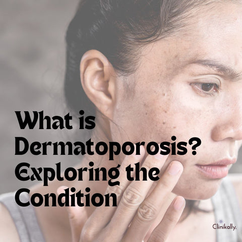 What is Dermatoporosis? Exploring the Condition