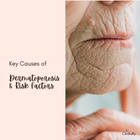 Key Causes of Dermatoporosis & Risk Factors