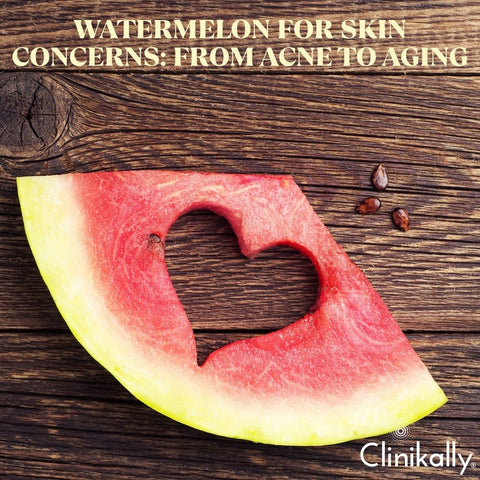 Watermelon for Skin Concerns: From Acne to Aging