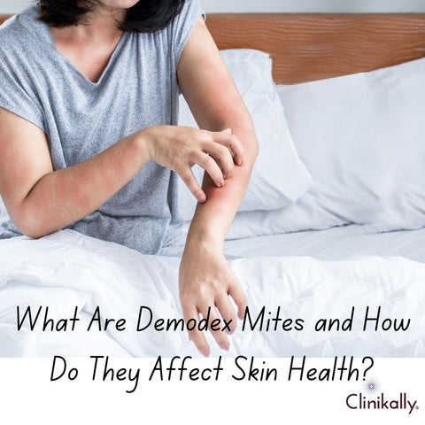 What Are Demodex Mites and How Do They Affect Skin Health?
