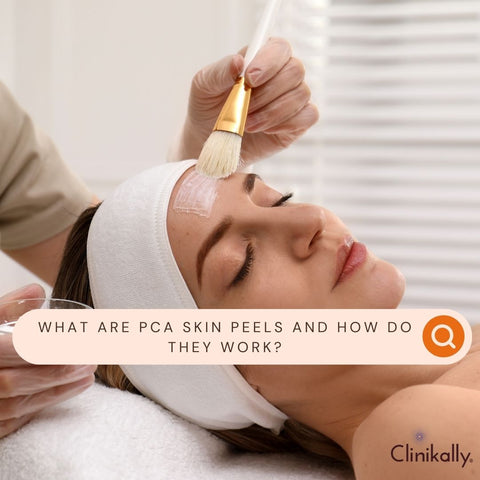 What Are PCA Skin Peels and How Do They Work?