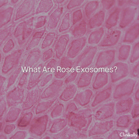 What Are Rose Exosomes?