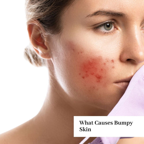What Causes Bumpy Skin