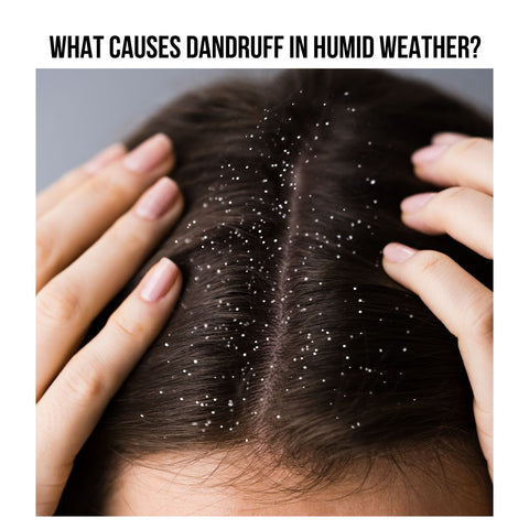 What Causes Dandruff in Humid Weather?