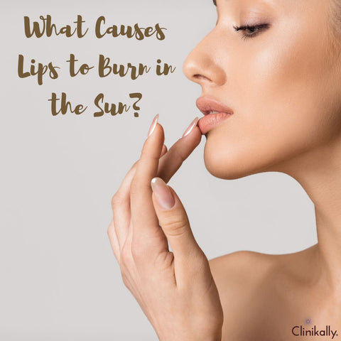 What Causes Lips to Burn in the Sun?