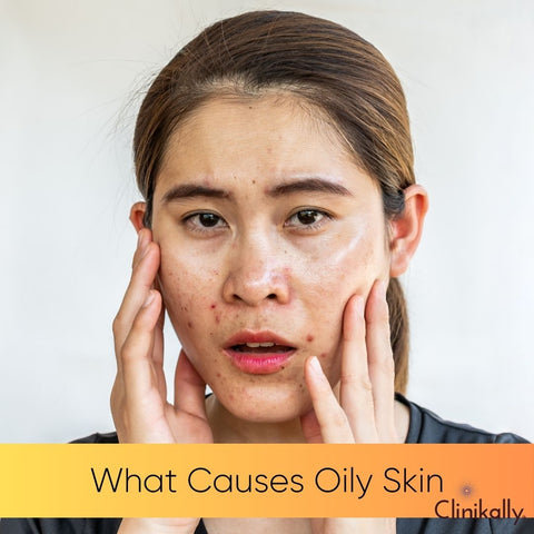 What Causes Oily Skin