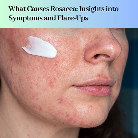 What Causes Rosacea: Insights into Symptoms and Flare-Ups