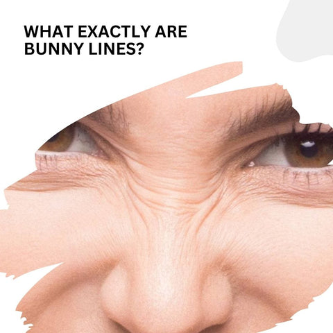 What Exactly Are Bunny Lines?