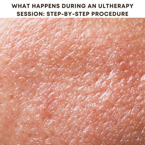 What Happens During an Ultherapy Session: Step-by-Step Procedure