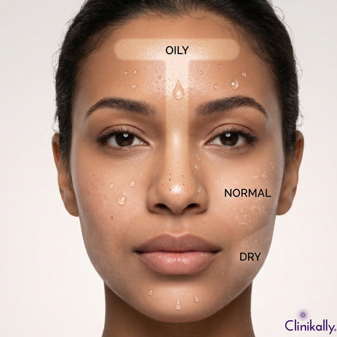 Combination skin with oily and dry facial zones