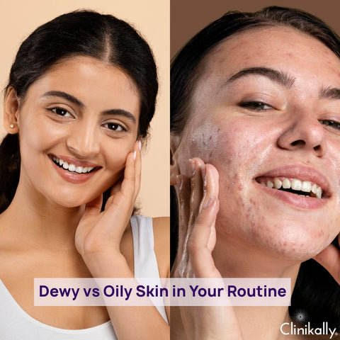 How to Manage and Differentiate Dewy vs Oily Skin in Your Routine
