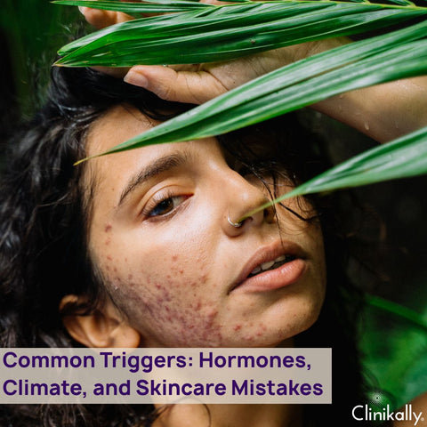 Common Triggers: Hormones, Climate, and Skincare Mistakes