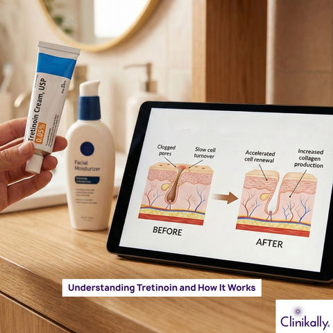What Is Tretinoin and How Does It Work?