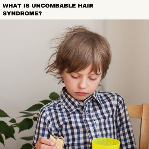 What Is Uncombable Hair Syndrome?