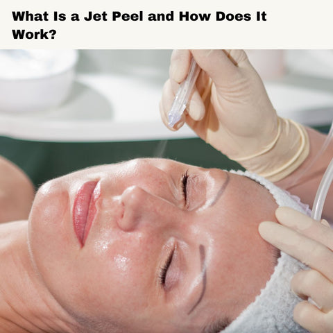 What Is a Jet Peel and How Does It Work?