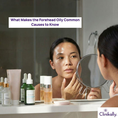Causes of an Oily Forehead