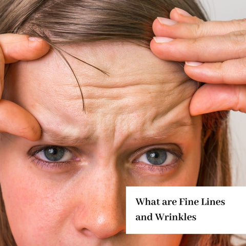 What are Fine Lines and Wrinkles