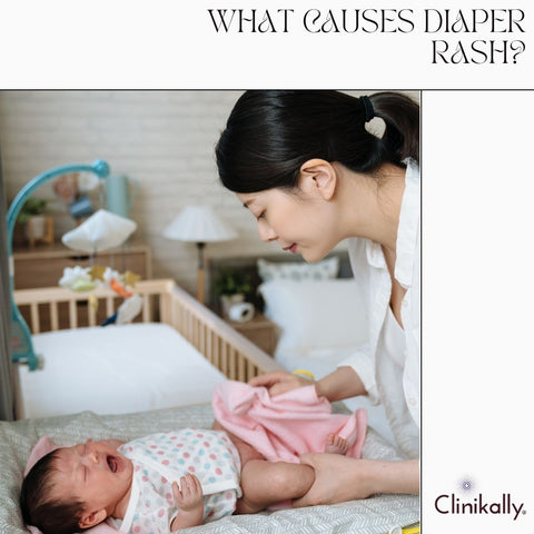 What causes diaper rash?