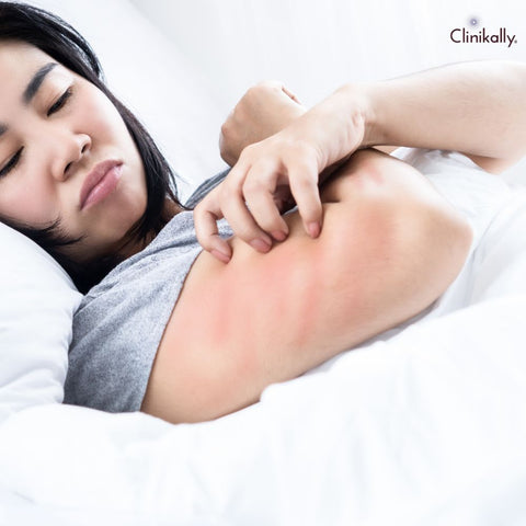 What causes itchy skin