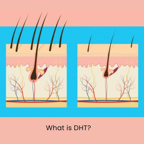 What is DHT?